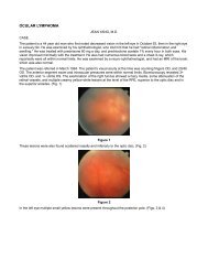 OCULAR LYMPHOMA - Ocular Immunology and Uveitis Foundation