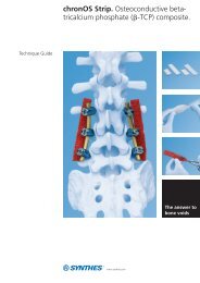 chronOS Strip. Osteoconductive beta- tricalcium ... - Synthes