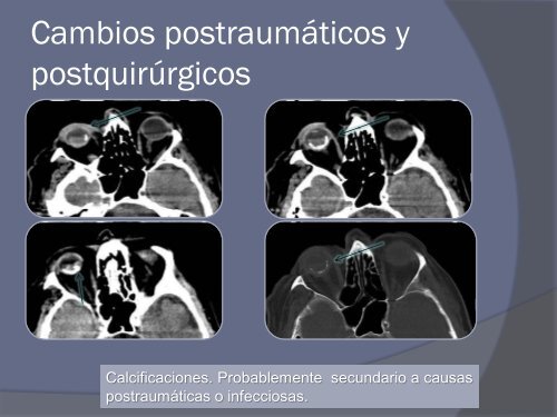 Diapositiva 1 - 30 Congreso de la SERAM. A Coruña. Mayo 2010.