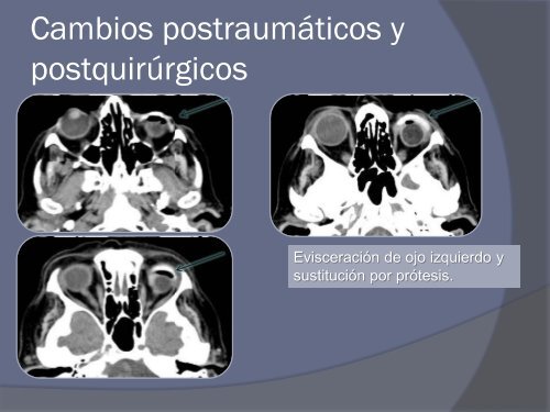 Diapositiva 1 - 30 Congreso de la SERAM. A Coruña. Mayo 2010.