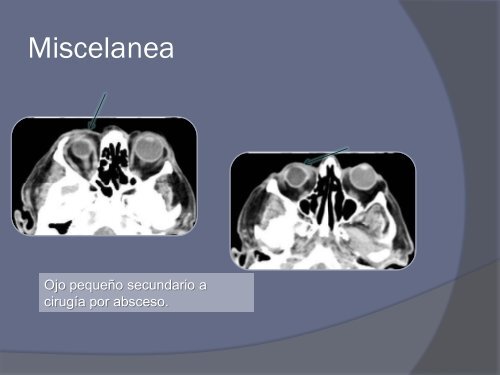 Diapositiva 1 - 30 Congreso de la SERAM. A Coruña. Mayo 2010.