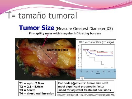 Seminario CÃ¡ncer de Mama