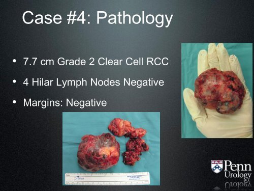 Jehovah's Witness Patients Undergoing Major Urologic Surgery in ...