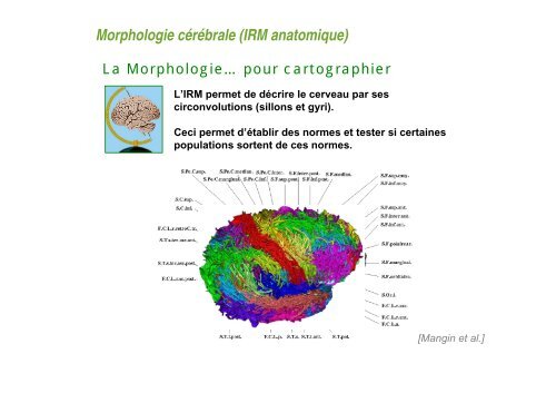 Comment obtenir une image en IRM ? - CEA Saclay
