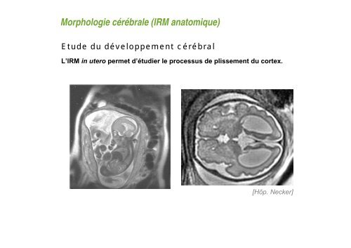 Comment obtenir une image en IRM ? - CEA Saclay