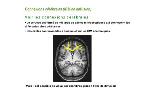 Comment obtenir une image en IRM ? - CEA Saclay