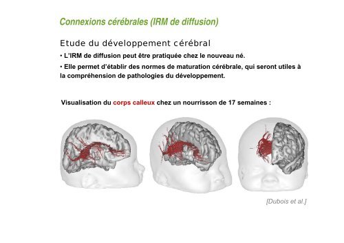 Comment obtenir une image en IRM ? - CEA Saclay