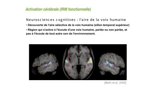 Comment obtenir une image en IRM ? - CEA Saclay