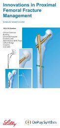 Innovations in Proximal Femoral Fracture Management - Synthes