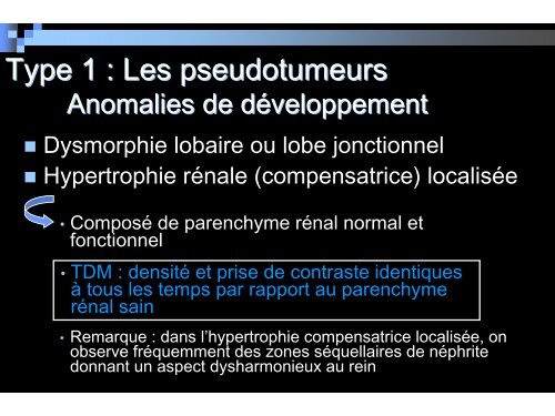 Masse solide du rein de l'adulte : dÃ©marche diagnostique