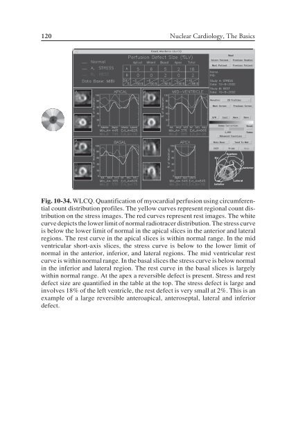 Nuclear Cardiology: Nuclear Cardiology: