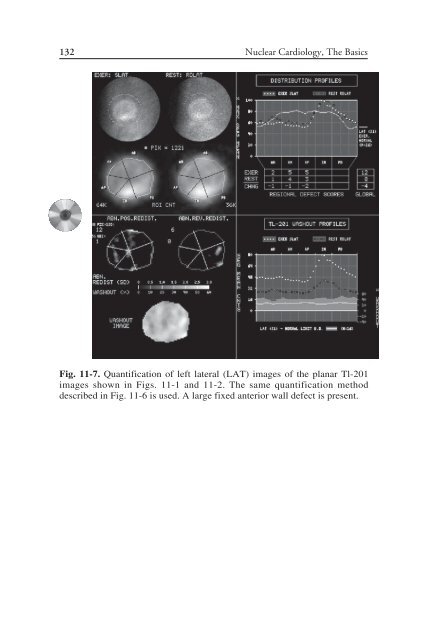 Nuclear Cardiology: Nuclear Cardiology: