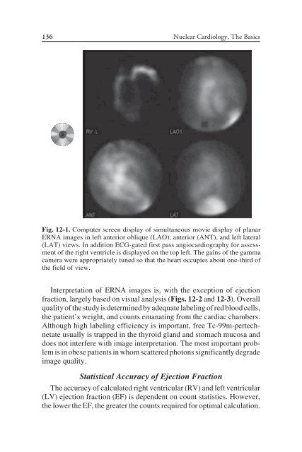 Nuclear Cardiology: Nuclear Cardiology: