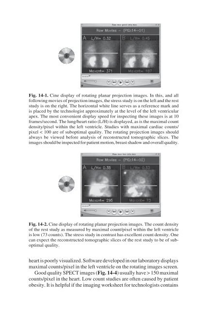 Nuclear Cardiology: Nuclear Cardiology: