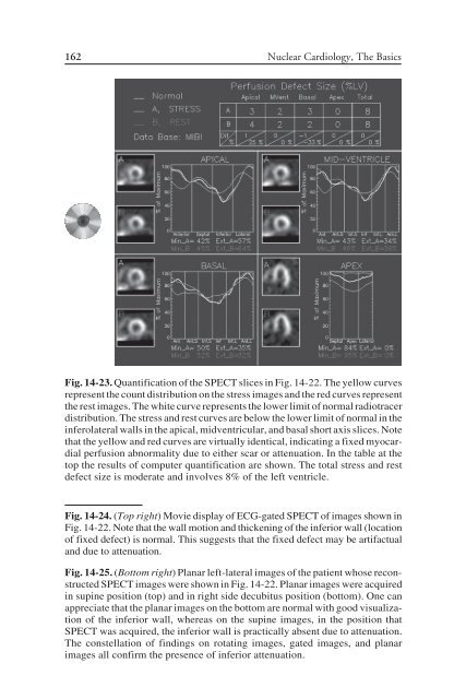 Nuclear Cardiology: Nuclear Cardiology: