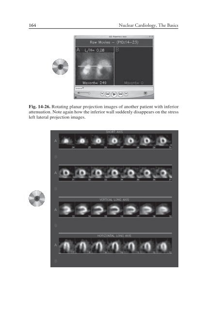 Nuclear Cardiology: Nuclear Cardiology: