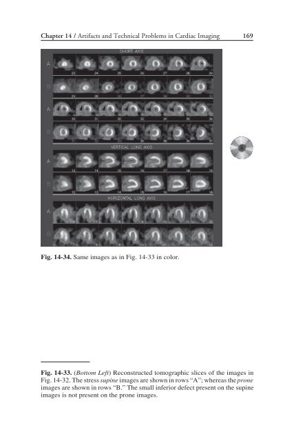 Nuclear Cardiology: Nuclear Cardiology: