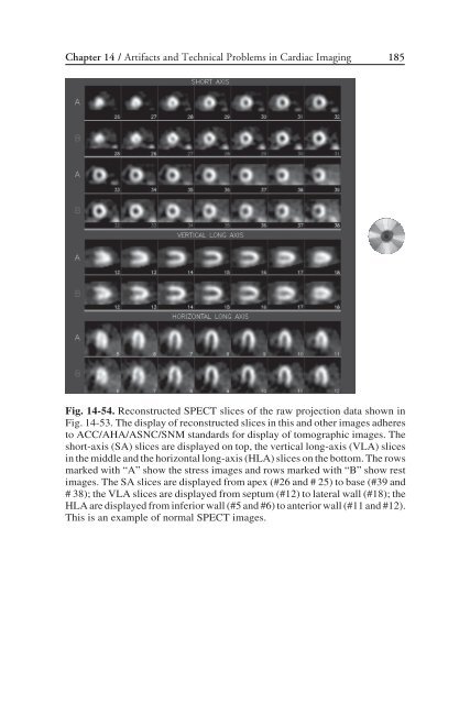 Nuclear Cardiology: Nuclear Cardiology: