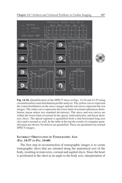 Nuclear Cardiology: Nuclear Cardiology: