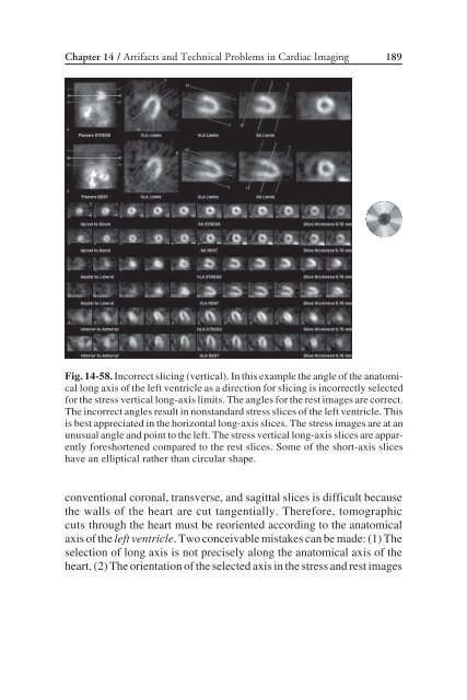 Nuclear Cardiology: Nuclear Cardiology: