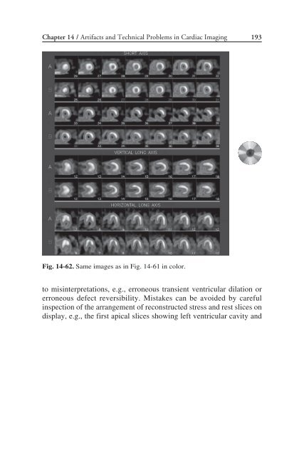 Nuclear Cardiology: Nuclear Cardiology: