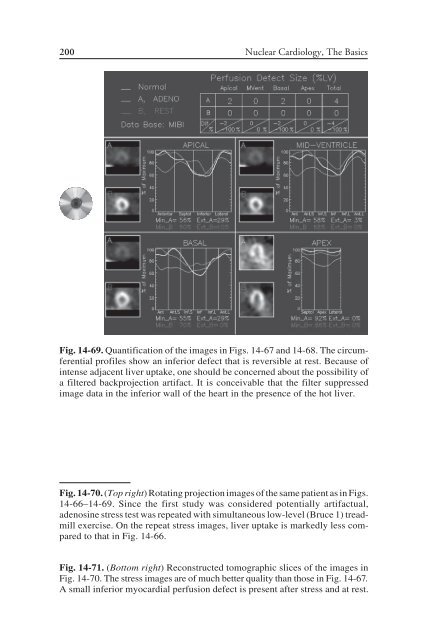 Nuclear Cardiology: Nuclear Cardiology: