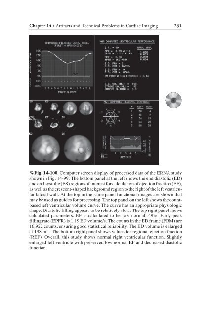 Nuclear Cardiology: Nuclear Cardiology: