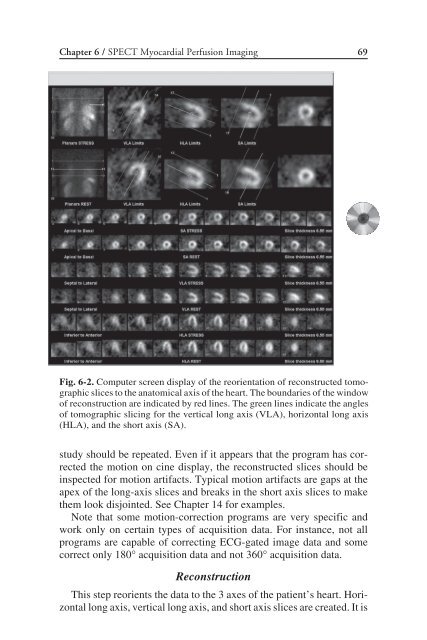 Nuclear Cardiology: Nuclear Cardiology: