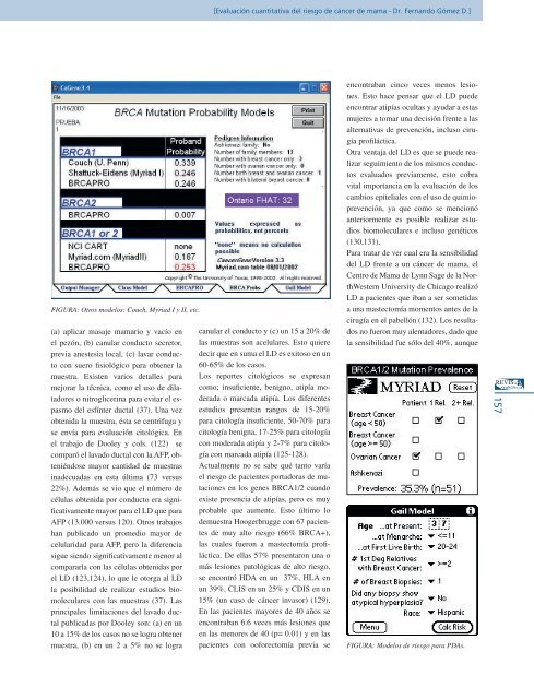 EvaluaciÃ³n cuantitativa del riesgo de cÃ¡ncer de mama