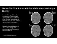 Neuro 3D Filter Reduce Noise while Maintain ... - GE Healthcare