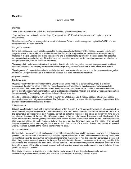 measles.pdf (75.47 KB) - Ocular Immunology and Uveitis Foundation