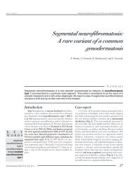 Segmental neurofibromatosis