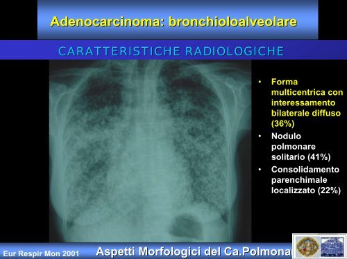 Presentazione di PowerPoint - Clinica malattie apparato respiratorio