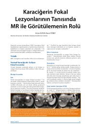 KaraciÄerin Fokal LezyonlarÄ±nÄ±n TanÄ±sÄ±nda MR ile ... - Klinik GeliÅim