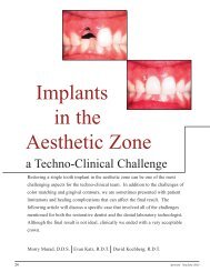 Implants in the Aesthetic Zone - Dentropolis