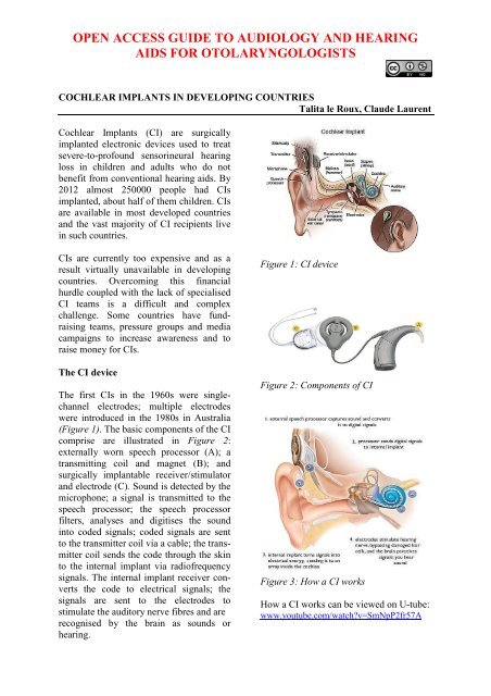 Cochlear Implants in Developing Countries - Vula - University of ...