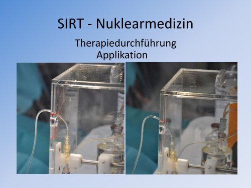 SIRT aus der Sicht des Nuklearmediziners