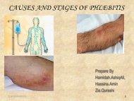 CAUSES AND STAGES OF PHLEBITIS - IUPUI