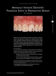 minimally invasive dentistry: paradigm shifts in preparation design