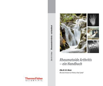 Rheumatoide Arthritis – ein Handbuch - Phadia