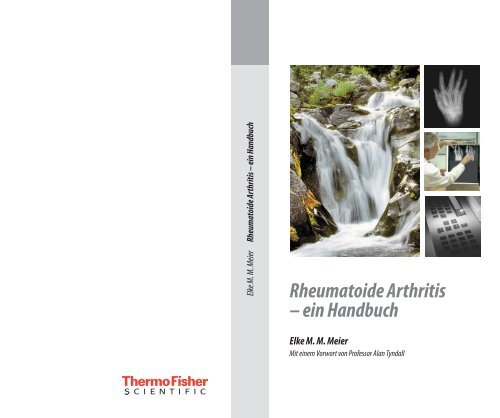 Rheumatoide Arthritis – ein Handbuch - Phadia