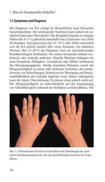 Rheumatoide Arthritis – ein Handbuch - Phadia