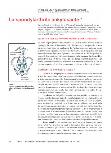 La spondylarthrite ankylosante - Moteurline - APF