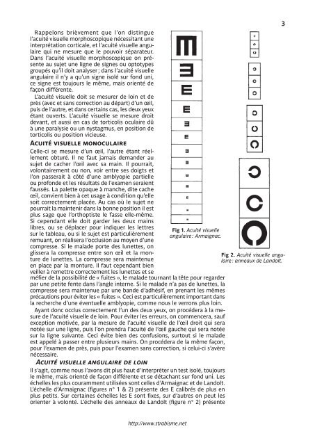 orthoptie pratique marie-josÃ© besnard - Strabisme