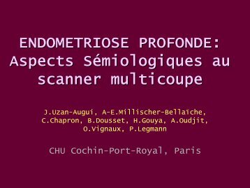 ENDOMETRIOSE PROFONDE: Aspects SÃ©miologiques au scanner ...