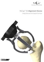 recapÂ® kS Alignment Device - Biomet