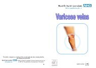 Varicose veins