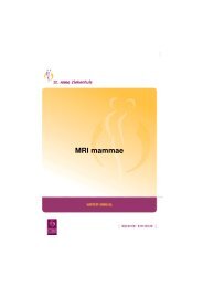 028 MRI mammae - St. Anna Zorggroep