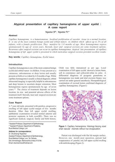 Atypical presentation of capillary hemangioma of upper eyelid