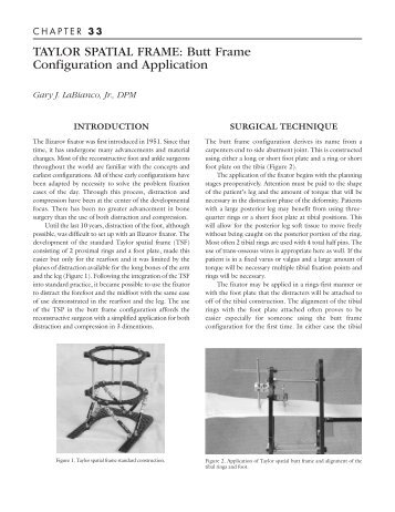 TAYLOR SPATIAL FRAME: Butt Frame Configuration and Application